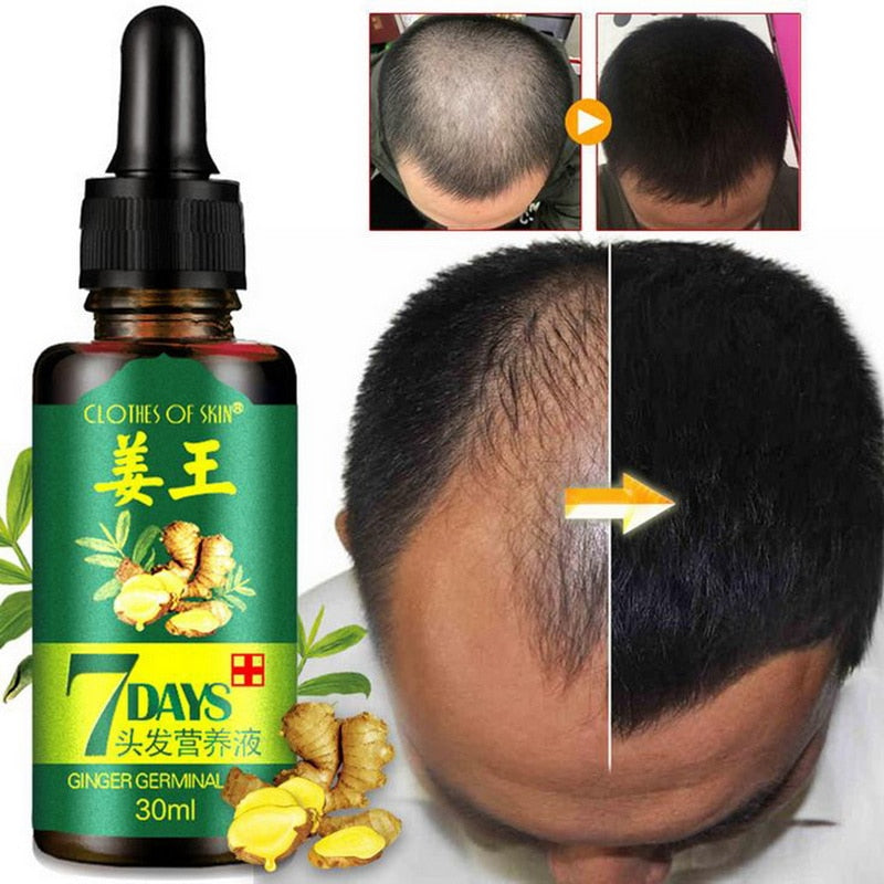 NATURAL 7DAYS HAIR REGROWTH SERUM